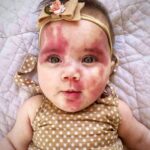 Baby called ‘hideous’ is a gorgeous little girl now