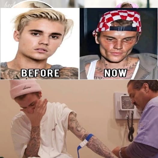 Justin Bieber admits that he tested positive for…
