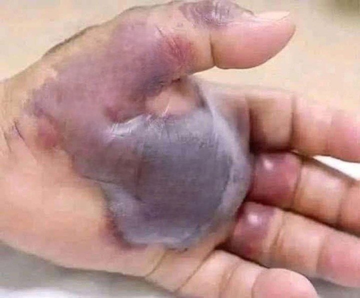 Early Warning Signs You Should Never Ignore: A Life-Saving Reminder